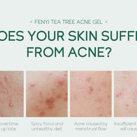 20g Moisturizing Skin Care Products